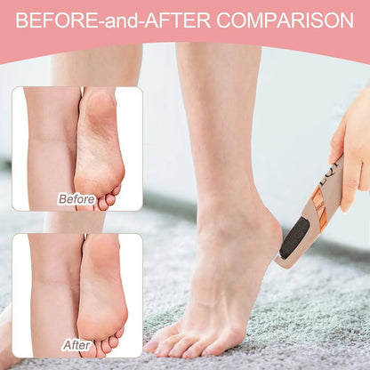 🎁Hot Sale 50% OFF-Electric Foot Callus Remover